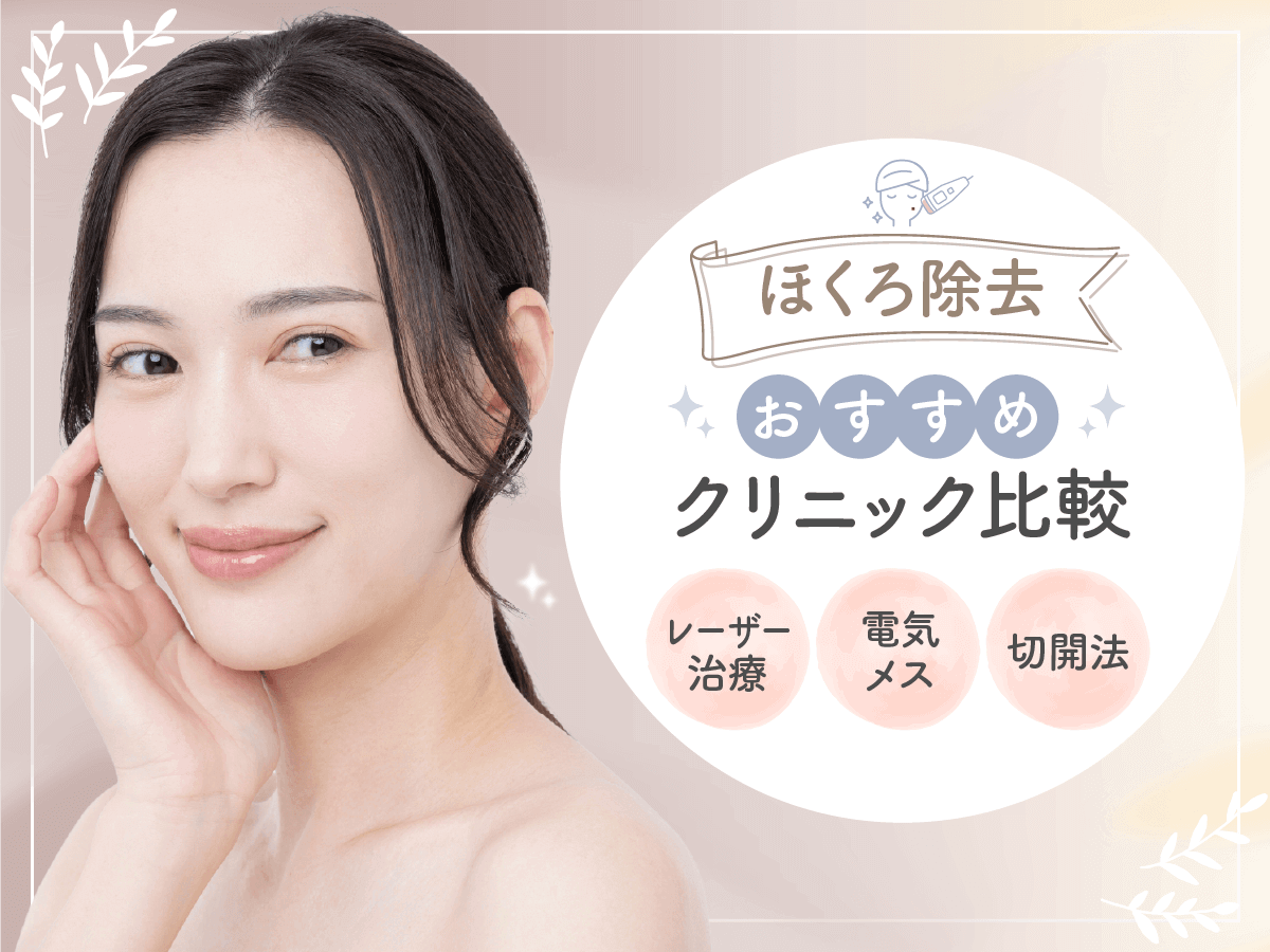 ほくろ除去おすすめクリニック比較！評判のいい病院と後悔しない選び方を徹底解説